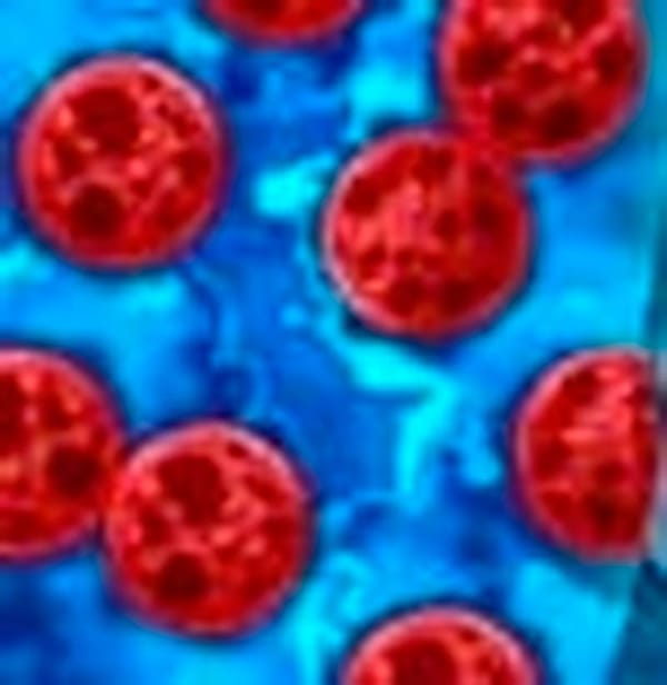Detectan el primer caso de cyclosporiasis en Veracruz; autoridades descartan riesgo de brote