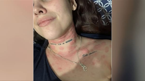 Crisis hídrica en Jalisco escala a nivel crítico: agua contaminada paraliza servicios de salud y desata protestas