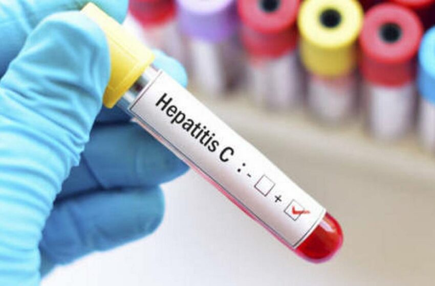  Descarta BC casos de hepatitis aguda en niños; buscan casos – La Voz de la Frontera