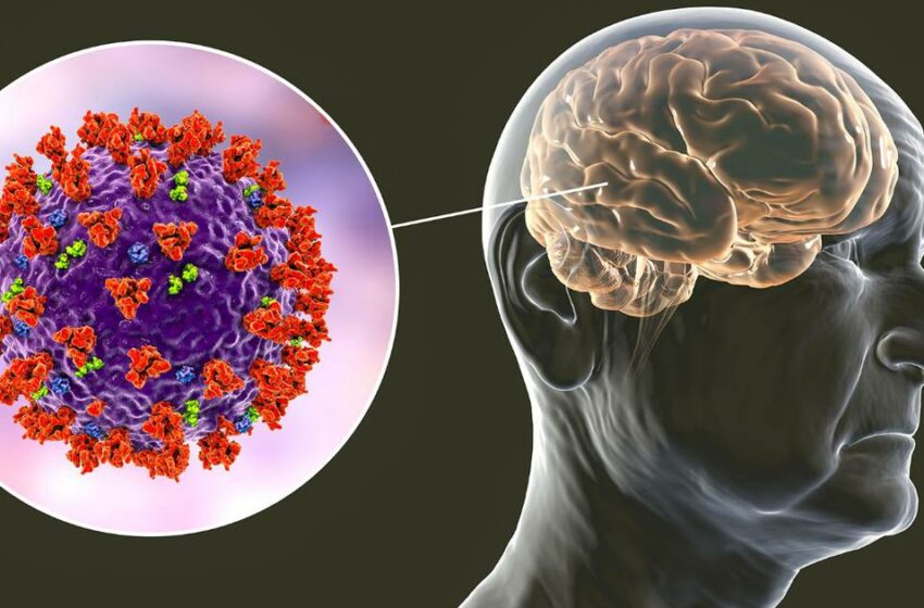  Daño cognitivo por COVID grave equivale a 20 años de envejecimiento: nuevo estudio