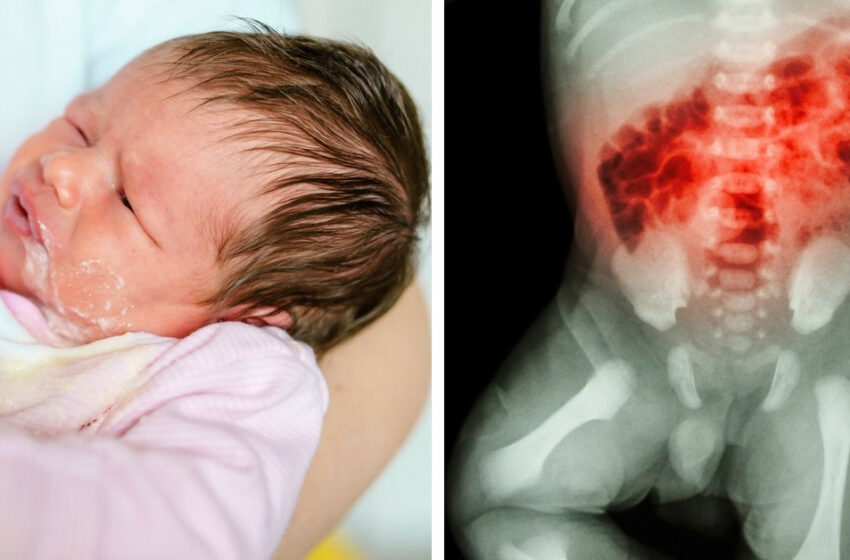  El peligro de darle “probaditas” a tu bebé antes de los 6 meses si tu leche no lo llena – Salud180