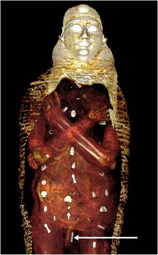  Momia de “chico de oro” portaba 49 amuletos, revelan tomografías