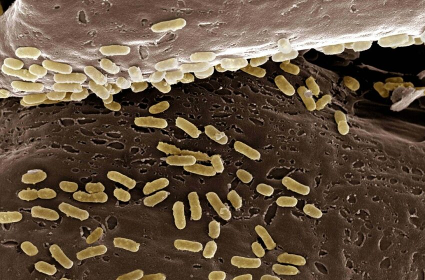  La bacteria E. coli puede “heredar” recuerdos