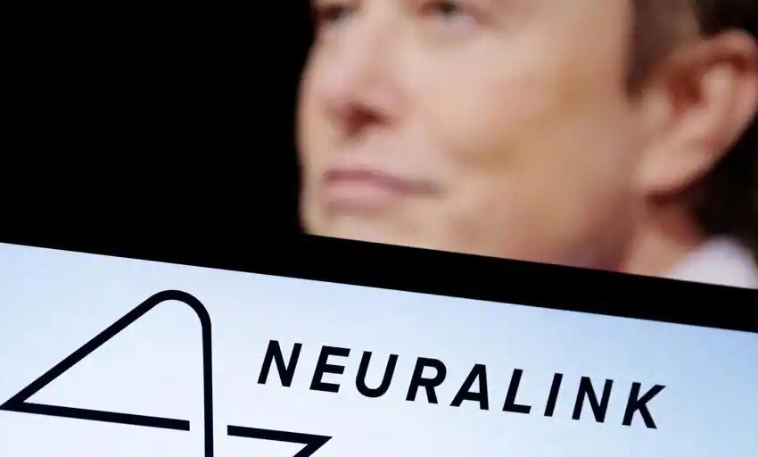  Elon Musk asegura que ha implantado su Neuralink en un ser humano