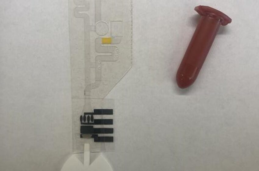  La insuficiencia cardíaca podría detectarse mediante una simple prueba de saliva