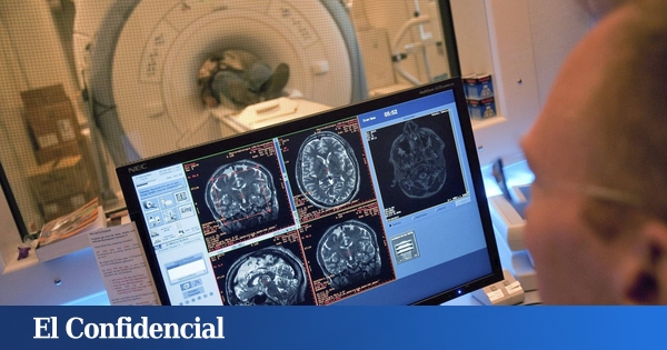  Descubren que cerebro ha aumentado drásticamente de tamaño en las últimas décadas