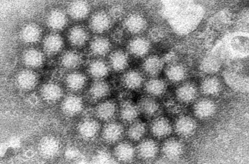  El norovirus regresa con fuerza y los casos en EU aumentan- Grupo Milenio