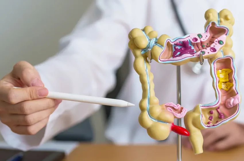  Alimentos que reducen riesgo de cáncer de colon – CB Televisión