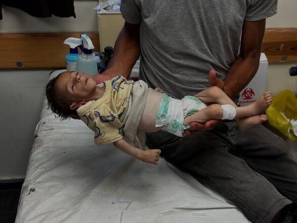 Lactante de 3 meses, muerto por inanición en la Franja de Gaza