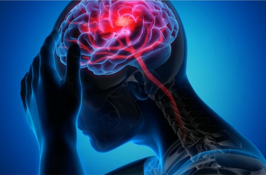 ¿Qué es un infarto cerebral? estos son los alimentos que reducen el riesgo … – El Heraldo de México