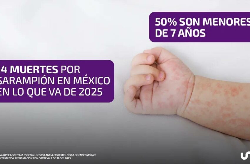  Suman 14 muertes por sarampión en México, 50% son menores de 7 años – UnoTV