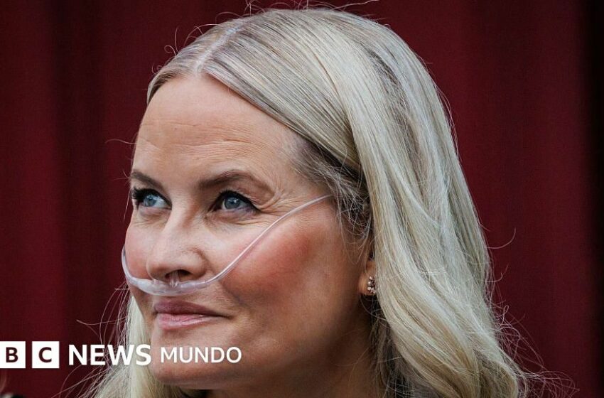  La princesa heredera de Noruega Mette-Marit se somete a un trasplante de pulmón – BBC