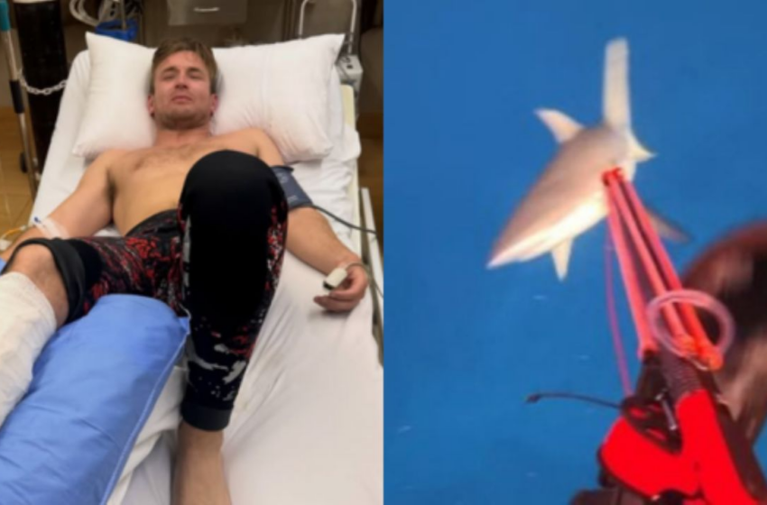  Influencer capta en video momento en que un tiburón ataca su pierna en Fiyi – ABC Noticias